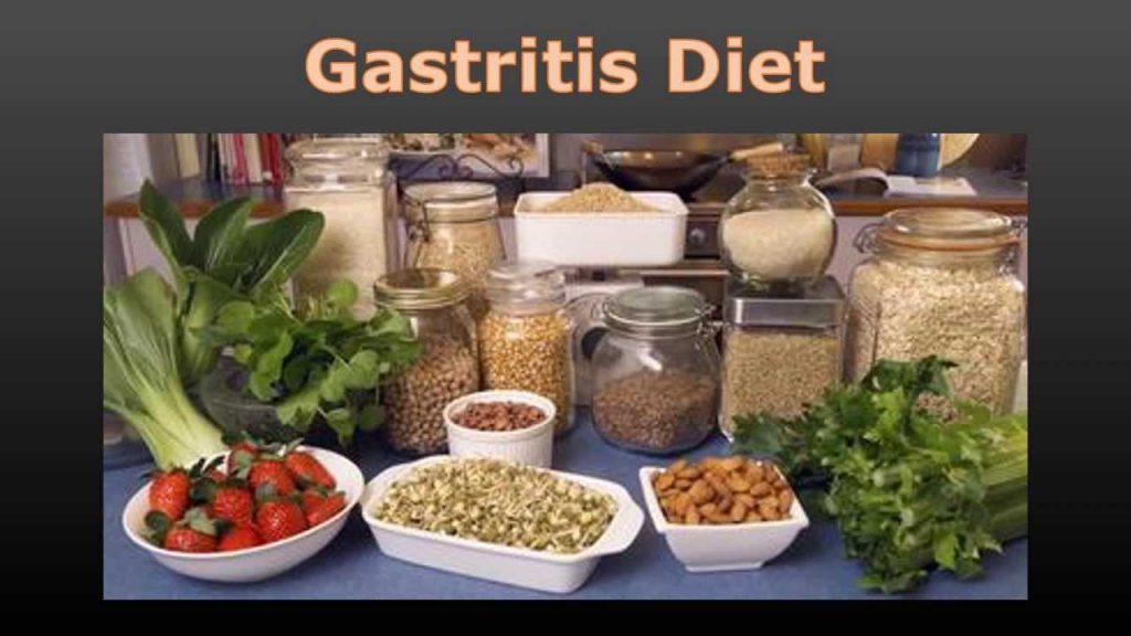 What Is Gastritissymptoms Causes Treatment Gastritis Diet And Remedies 3598