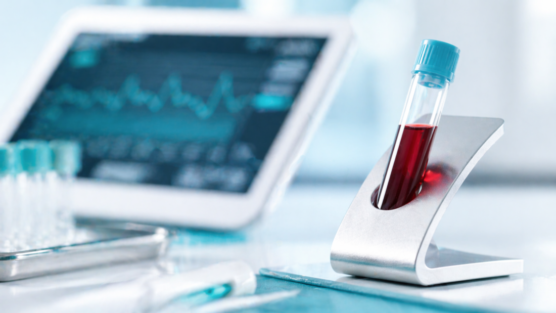 Ein Reagenzglas mit einer Blutprobe in einem modernen Labor – Visualisierung der jährlichen Blutwert-Checkliste für die Gesundheitsvorsorge.